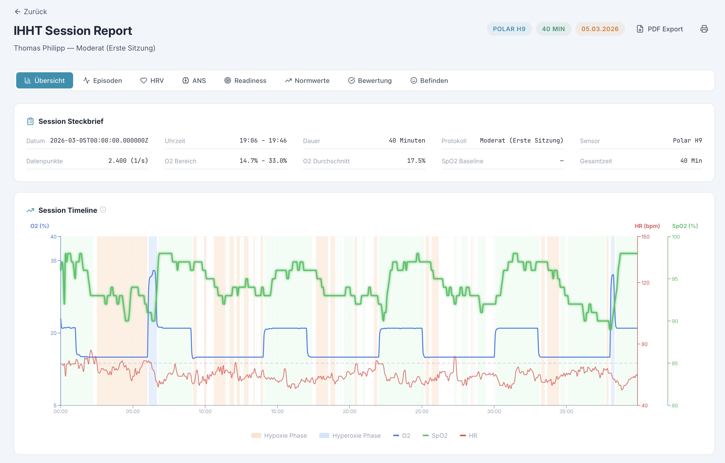 HRV Analysis Overview